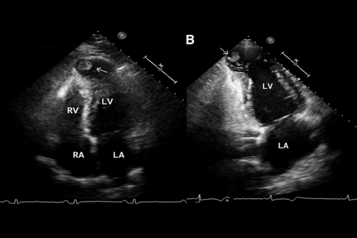 Projeto que permite diagnóstico precoce de cardiopatias é premiado