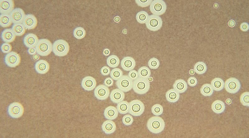 A resistência do Cryptococcus neoformans aos antifúngicos foi alterada devido à exposição aos agrotóxicos (Public Health Image Library)