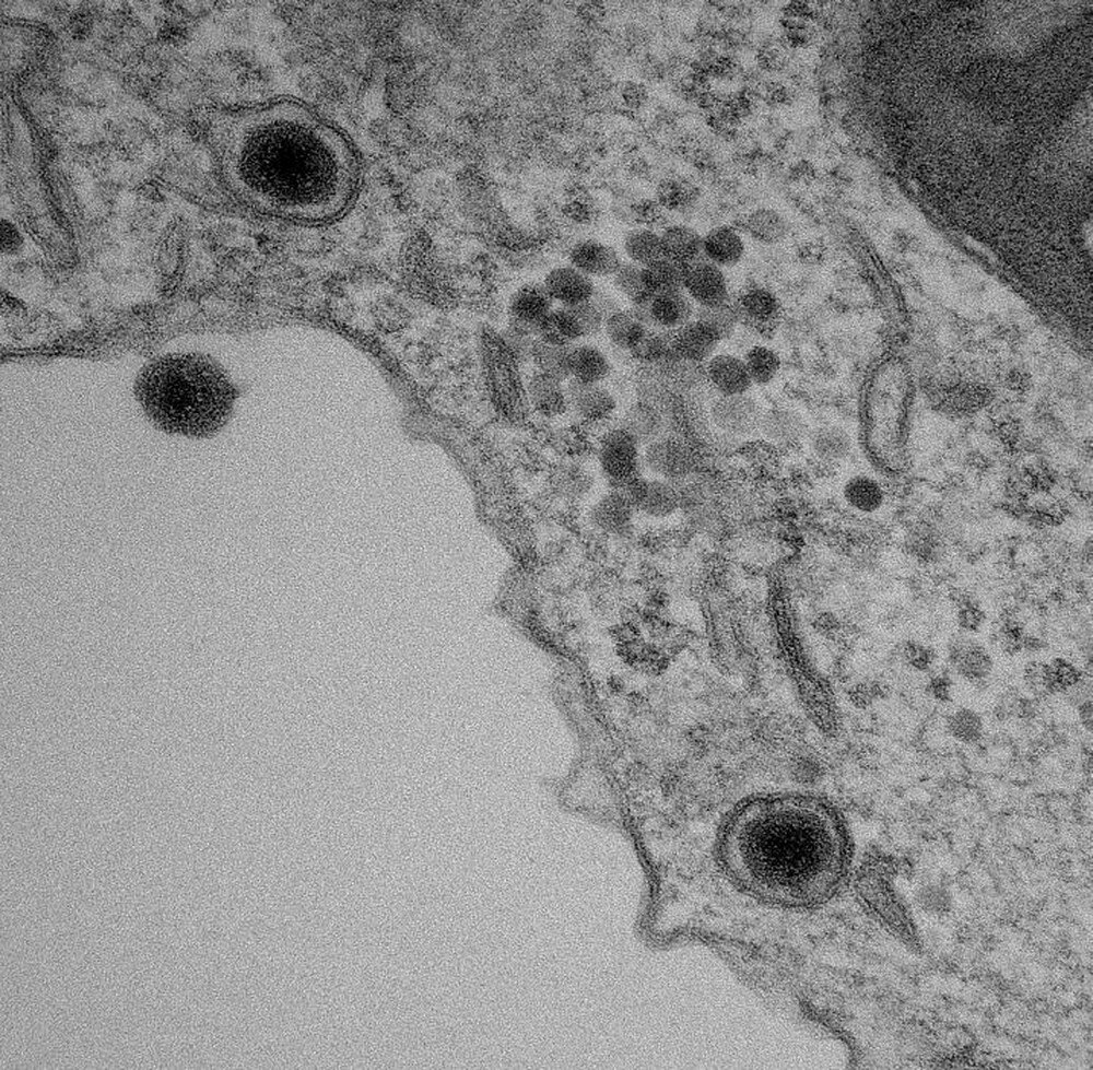 Yaravirus: descoberta e boatos